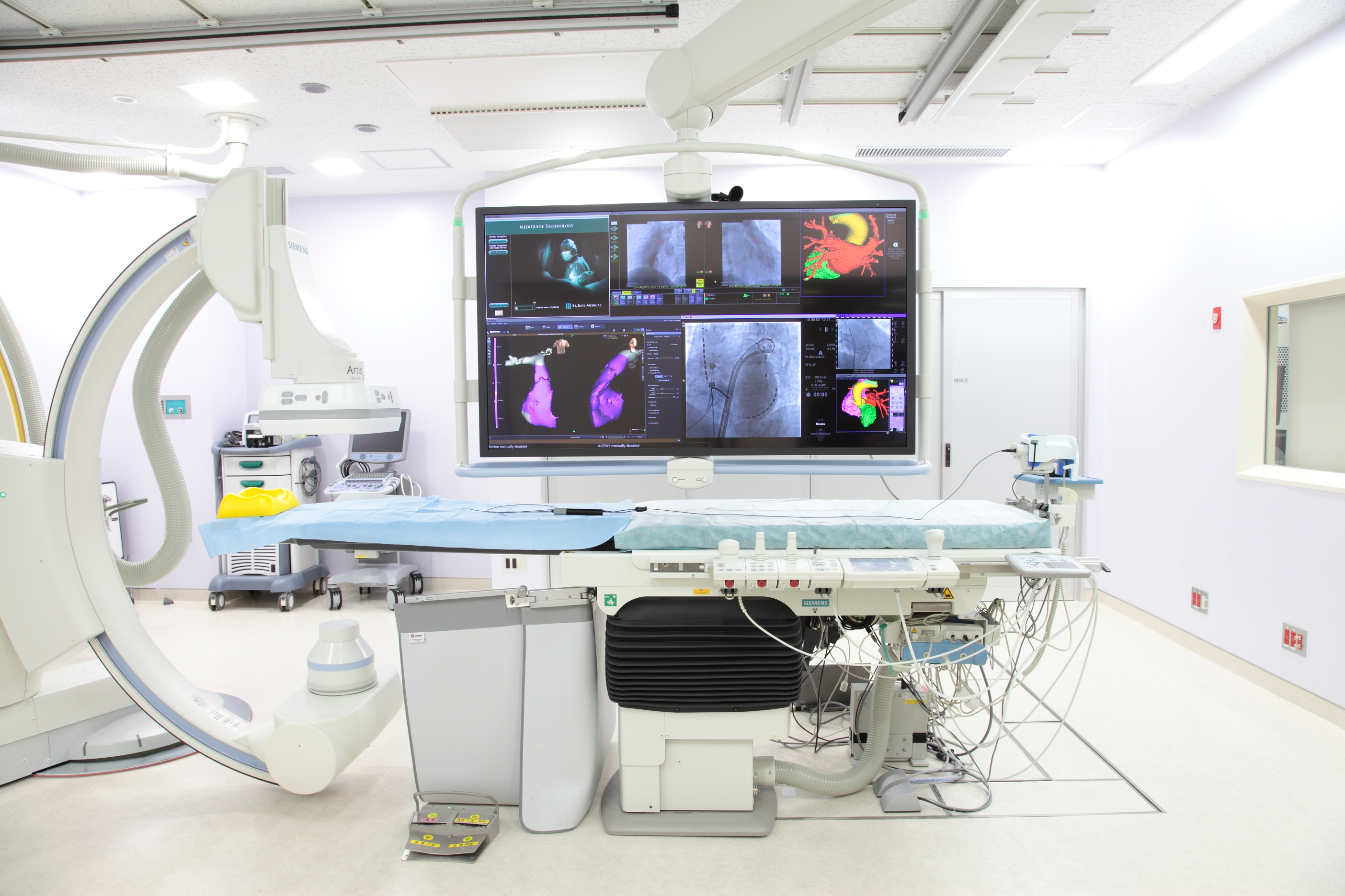 セント ジュード メディカル 日本でmediguide テクノロジーの薬事承認を取得 アジア初 杏林大学医学部付属病院に導入 アボットのプレスリリース