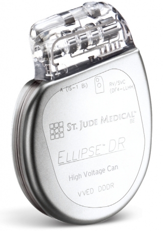 セント ジュード メディカル 植込み型除細動器 Icd Ellipse でmri対応の医療機器製造販売承認を取得 患者様にmri撮像の機会を提供 アボットのプレスリリース