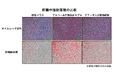 【摂南大学】水溶性食物繊維 ”グアーガム分解物” のアルコール性脂肪肝の改善効果を解明