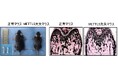 RNA修飾酵素METTL5が骨形成を支えるしくみを解明～国際共同研究により、骨形成異常に関わる抗酸化制御機構を発見～