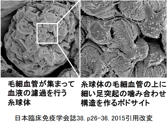 図２. 走査電子顕微鏡で見た糸球体とポドサイト