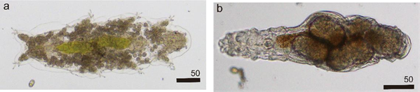 図２　月山の積雪中から発見された（a）クマムシ、（b）ワムシ。右下のスケールは50 µm（マイクロメートル）。 クマムシの体内には、緑色をした藻類の葉緑素が透けて見える。
