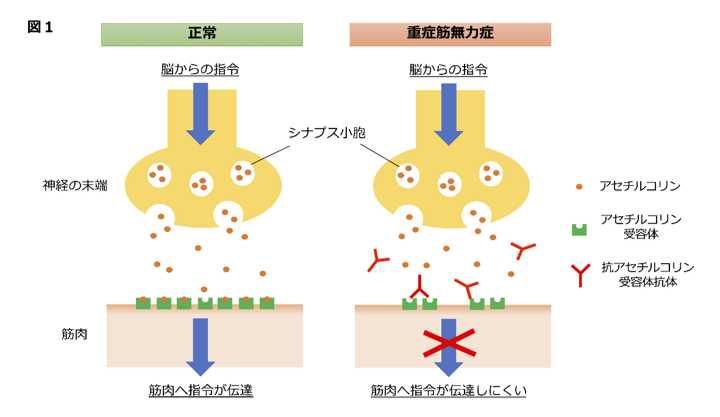 指定難病 重症筋無力症 の予後予測に有用なマーカーを発見 治療の最適化による副作用軽減 生活の質改善に期待 国立大学法人千葉大学のプレスリリース