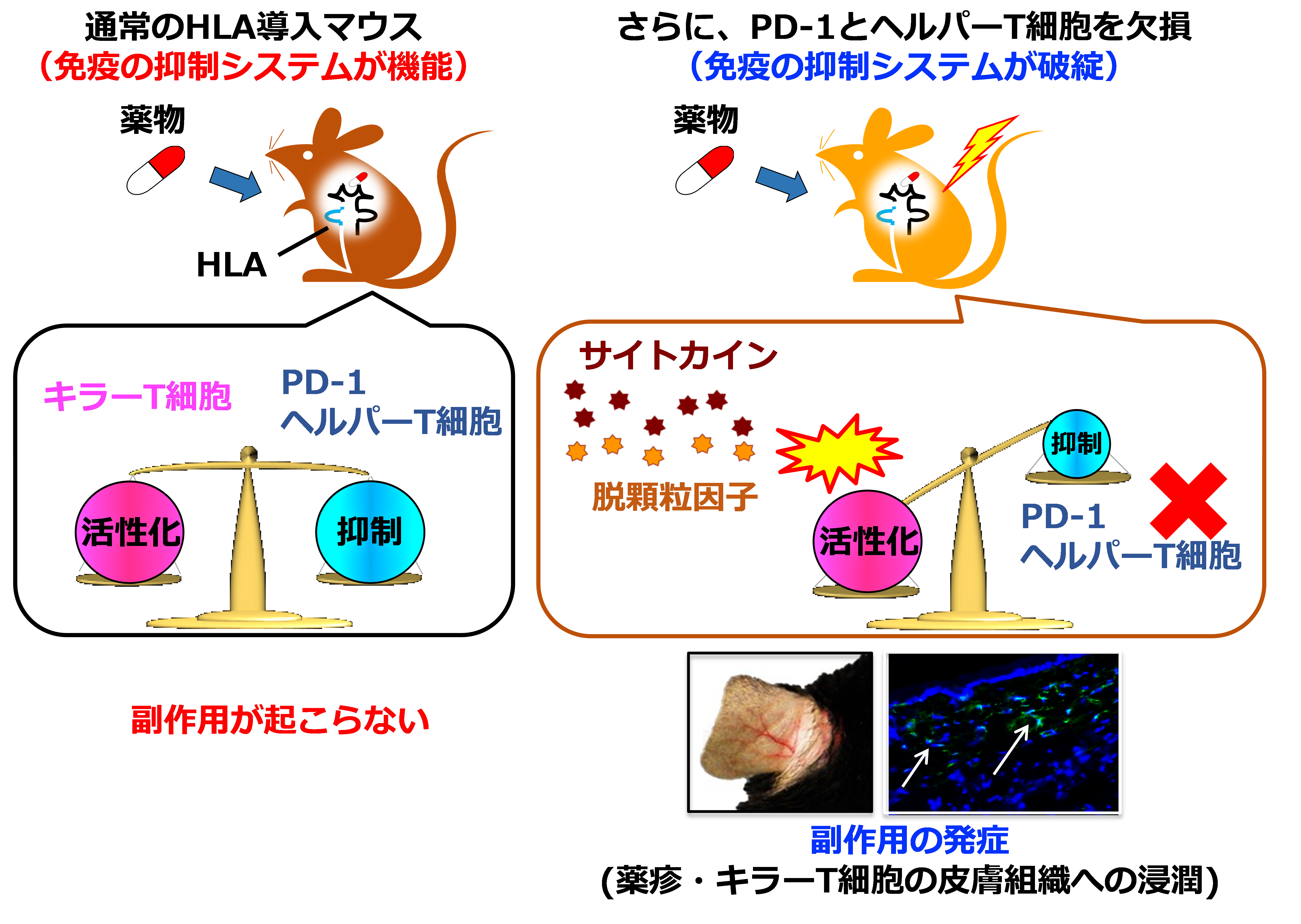 免疫の抑制系が医薬品による副作用発症をコントロールすることを発見 国立大学法人千葉大学のプレスリリース