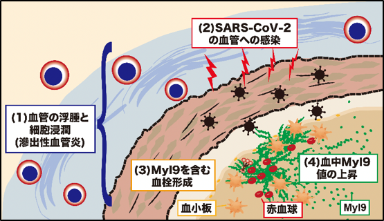 本臨床研究の成果の概要(COVID-19重症化機構) 本臨床研究の成果の概要(COVID-19重症化機構)