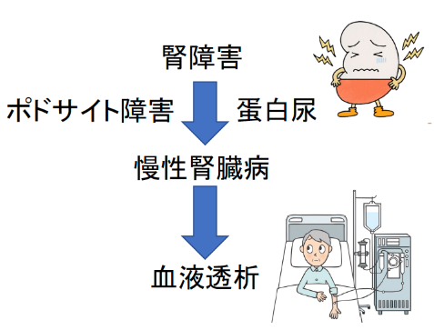 図1：さまざまな腎疾患でポドサイト障害が起き慢性腎臓病が進行していく