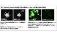 がんの転移を調節するタンパク質Mdm2と新たな仕組みを発見~がんの新たな治療薬の開発につながる可能性~