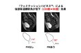 銀座リプロ外科、第28回日本女性骨盤底医学会で演題「フェミクッションハピネス™装着による骨盤底の変化-MRIによる解析-」を発表
