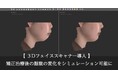 松山市の大谷歯科矯正歯科、3Dフェイススキャナー「MORPHEUS3D SCANNER」を導入。矯正治療後の顔貌変化をリアルな３次元シミュレーションで可視化