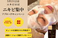 5月21日はニキビの日。肌悩みに寄り添うキャンペーンを実施します。