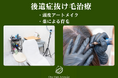 頭皮アートメイクによる「後遺症抜け毛治療」。放射線治療・頭部の怪我・コロナ等の後遺症での抜け毛に悩む方への治療を。薬による育毛との並行治療も可能。頭皮アートメイク専門の看護師 月乃なつ