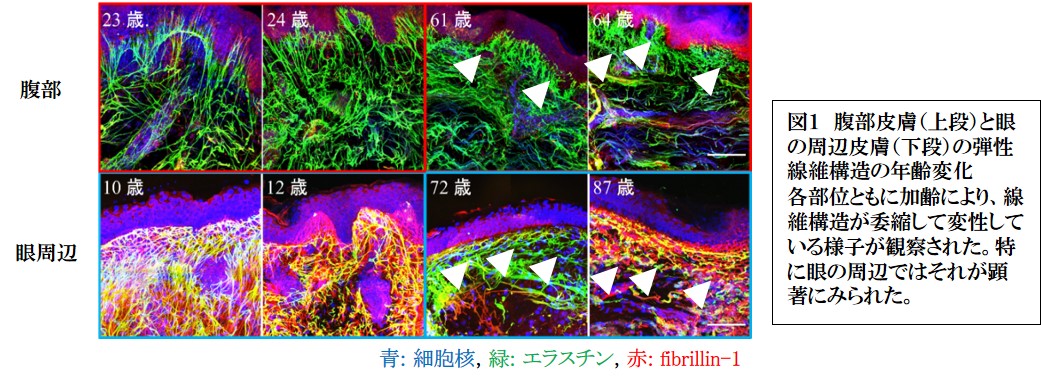 皮膚の透明化技術で ｅｍｉｌｉｎ 1 が弾性線維に重要であることを発見 株式会社ファンケルのプレスリリース