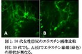 【研究情報】シワの原因であるエラスチンの「質」の低下に肌の敏感性が関わることを発見
