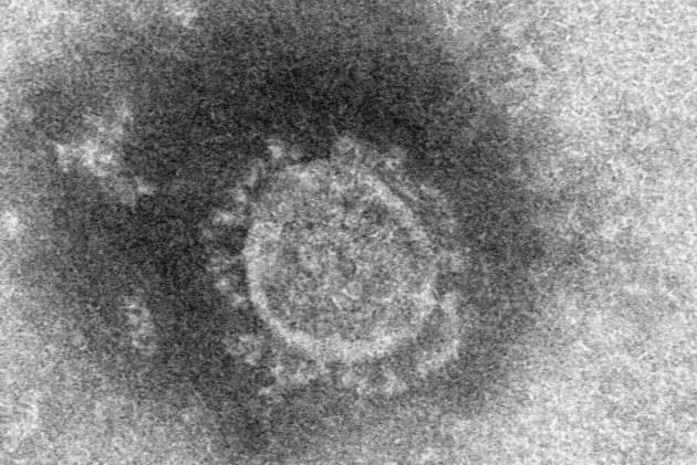 新型コロナウイルスの電子顕微鏡写真（国立感染症画像提供）
