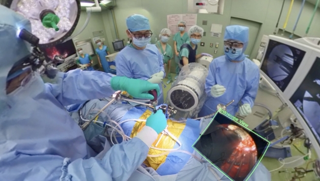 ▲整形外科手術、椎体置換術のVRイメージ