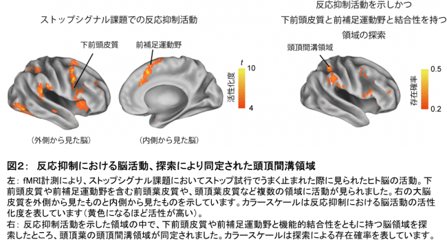 図２：　反応抑制における脳活動、探索により同定された頭頂間溝領域