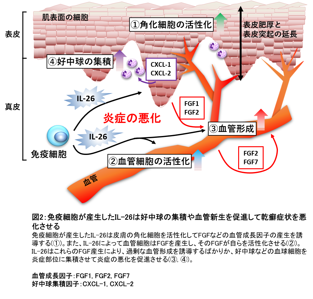 炎症 Inflammation JapaneseClass.jp