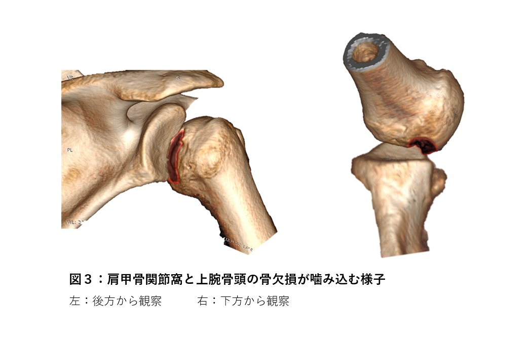 肩の骨