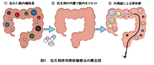 図1：　抗生剤併用便移植療法の概念図