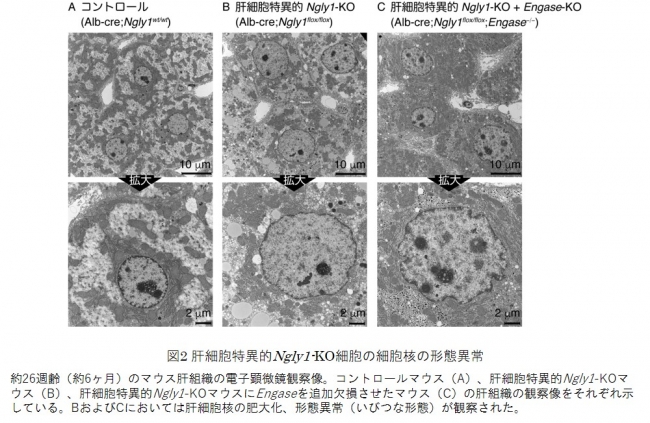図2 肝細胞特異的Ngly1-KO細胞の細胞核の形態異常
