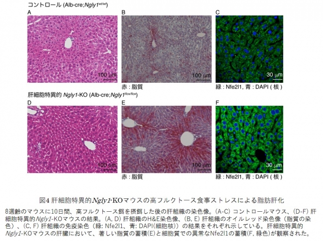 図4 肝細胞特異的Ngly1-KOマウスの高フルクトース食事ストレスによる脂肪肝化