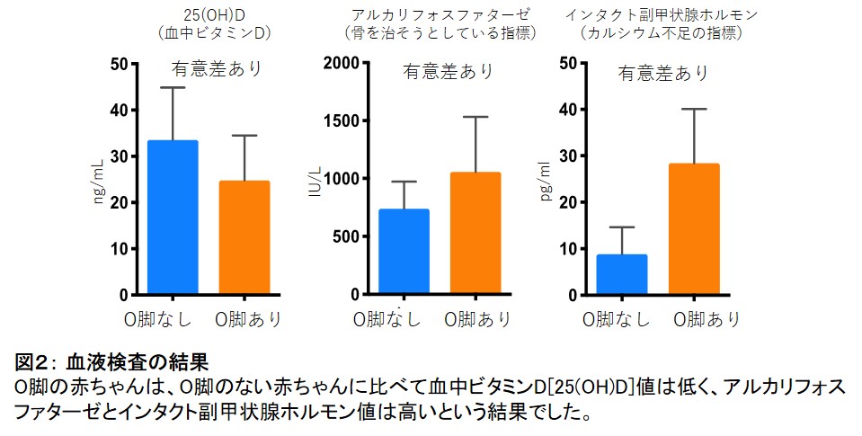 世界初 よちよち歩きの赤ちゃんのo脚の原因を解明 学校法人 順天堂のプレスリリース