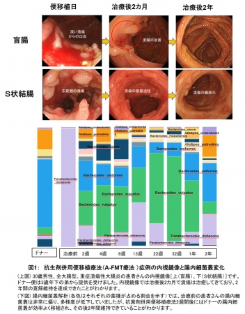 図1：　抗生剤併用便移植療法（A-FMT療法 ）症例の内視鏡像と腸内細菌叢変化