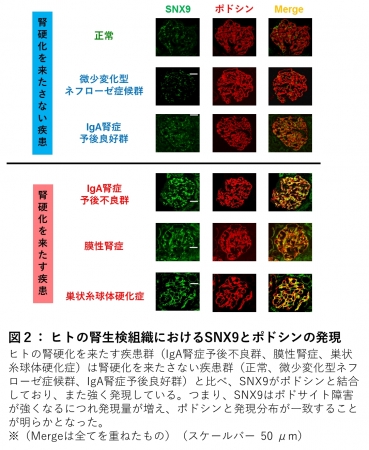 図２： ヒトの腎生検組織におけるSNX9とポドシンの発現