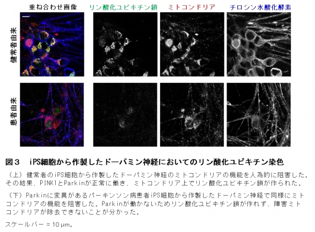 図３　iPS細胞から作製したドーパミン神経においてのリン酸化ユビキチン染色