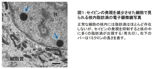 図１：セイピンの発現を減少させた細胞で見られる核内脂肪滴の電子顕微鏡写真