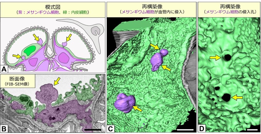 電子顕微鏡像の3d再構築技術により糸球体内皮細胞の正常構造を完全解明 学校法人 順天堂のプレスリリース