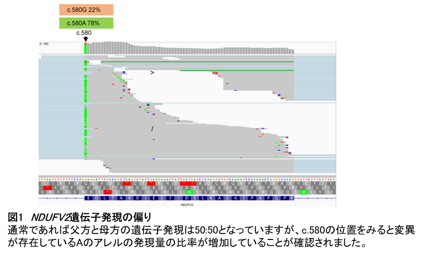 マルチオミクス解析によりミトコンドリア病未解決症例の原因を特定 学校法人 順天堂のプレスリリース