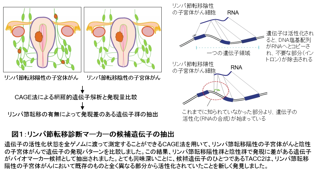 子宮体がん病巣よりリンパ節転移を見分けるバイオマーカーの発見 学校法人 順天堂のプレスリリース