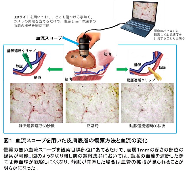 図1:血流スコープを用いた皮膚表層の観察方法と血流の変化 図1:血流スコープを用いた皮膚表層の観察方法と血流の変化
