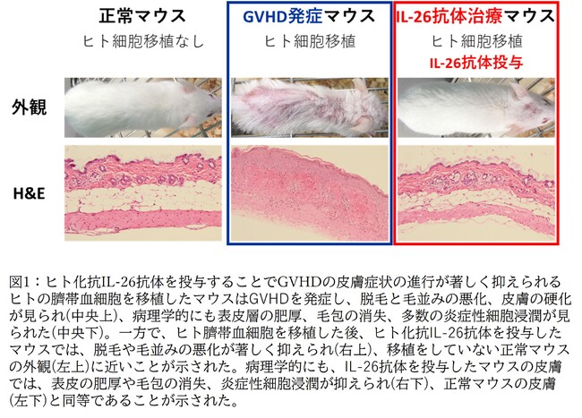 図1:ヒト化抗IL-26抗体を投与することでGVHDの皮膚症状の進行が著しく抑えられる 図1:ヒト化抗IL-26抗体を投与することでGVHDの皮膚症状の進行が著しく抑えられる
