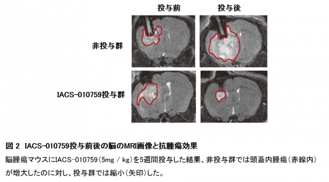 図 2　IACS-010759投与前後の脳のMRI画像と抗腫瘍効果