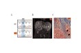 脂肪肝・肝硬変を食い止める分子モーター