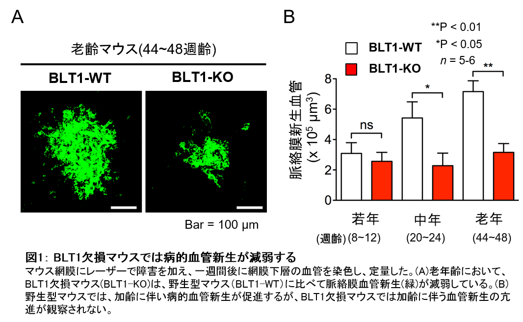 加齢黄斑変性症の病的血管新生のメカニズムを解明 学校法人 順天堂のプレスリリース