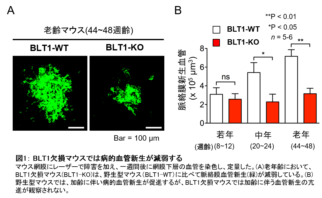 加齢黄斑変性症の病的血管新生のメカニズムを解明 学校法人 順天堂のプレスリリース