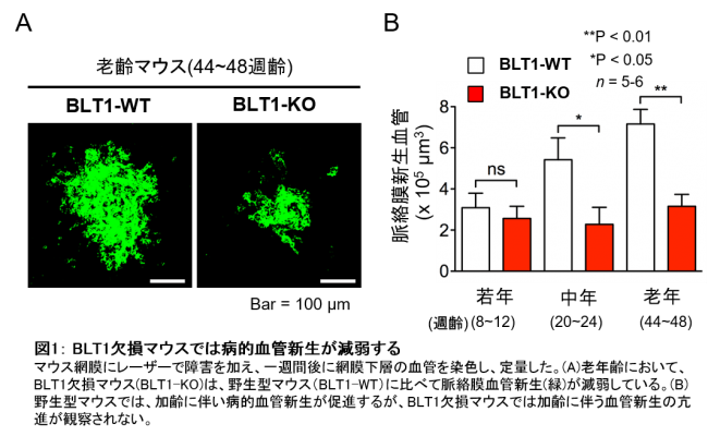 図1： BLT1欠損マウスでは病的血管新生が減弱する