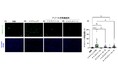 アゾール系抗真菌薬はマルチキナーゼ阻害薬による表皮細胞障害を抑制する