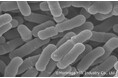 ビフィズス菌M-63が新生児のビフィズス菌優勢な腸内菌叢の形成を促進し、腸内の炎症状態を軽減させることを確認-松本市立病院との共同での研究-