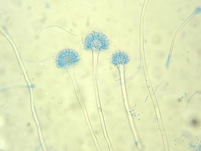 「奇跡の菌」と言われるアスペルギルス オリゼ