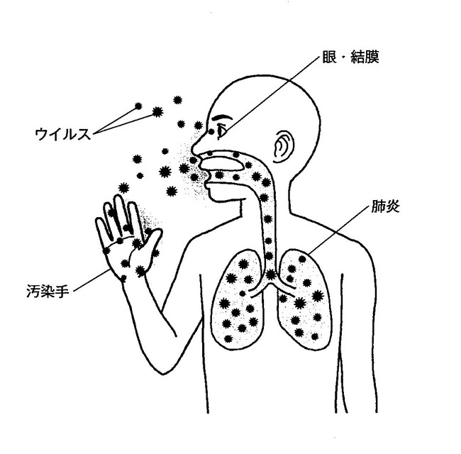 くしゃみや咳などによる飛沫感染と、ウイルスを含むものや場所に触れた手から鼻や口感染する接触感染が2大感染経路であるが、目の結膜を介して感染したとする報告もある
