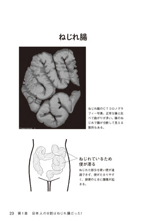 便秘にいいと言われるものを食べても 出ない人 は ねじれ腸 や 落下腸 かもしれません 便の渋滞を解消するには 快うんマッサージ が効果テキメン 株式会社主婦の友社 のプレスリリース