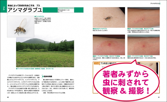 NHK総合「ガッテン」で紹介された『Dr.夏秋の臨床図鑑 虫と皮膚炎