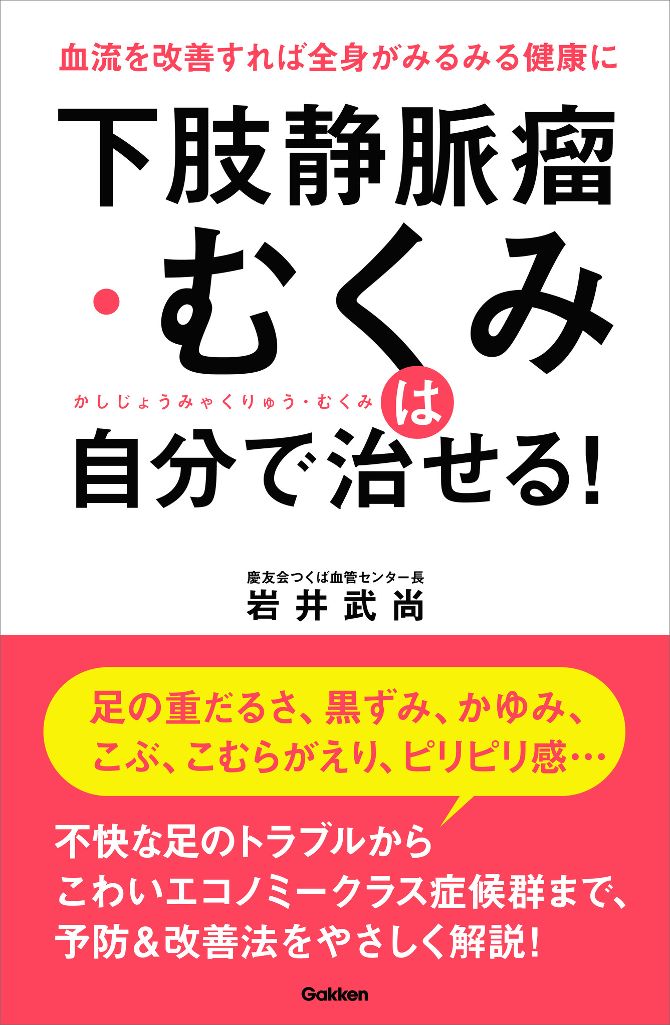 足がむくむ だるい かゆい 当てはまったら要注意 潜在患者1000万人以上の 下肢静脈瘤 とは 株式会社 学研ホールディングスのプレスリリース