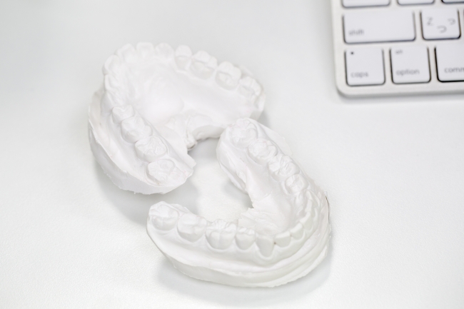 3Dプリンタでつくられる歯型模型