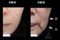 ほほの外形から「たるみ指数」を測定する新評価法を確立