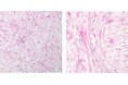 セイタカミロバラン果実に表情筋ケア効果を発見